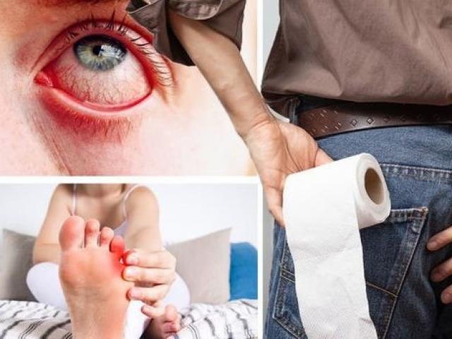 Những triệu chứng của chủng Coronavirus mới, không phải là “3 triệu chứng cổ điển”