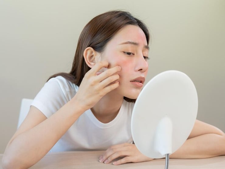 Cứu nguy làn da tổn thương do nắng nóng, đây là bí kíp bạn không thể bỏ qua