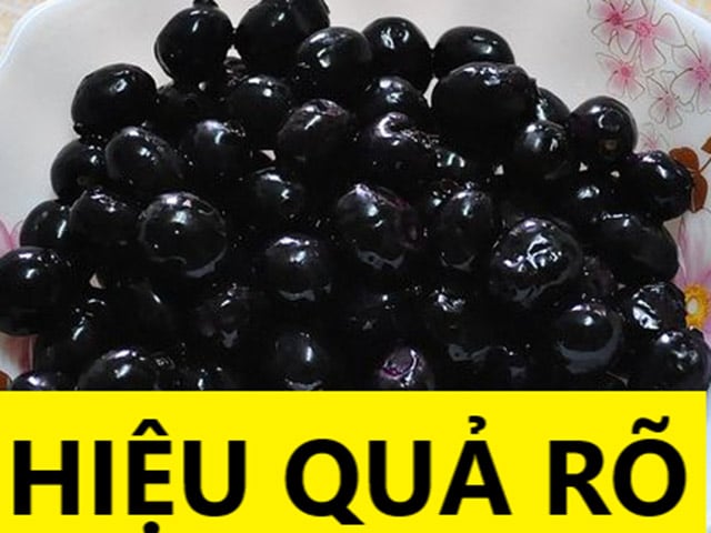 Đừng bảo rối loạn tiền đình, thiếu máu não là bệnh người già không chữa được: Học người miền Tây cách này đảm bảo sẽ cải thiện